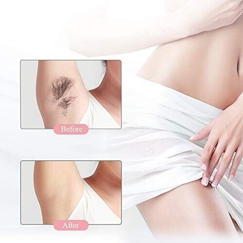 Gesichtshaarentfernung, schmerzfrei,schmerzfrei, Lippenstift Gesichtshaarentfern